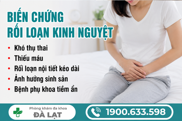 Hình ảnh minh họa